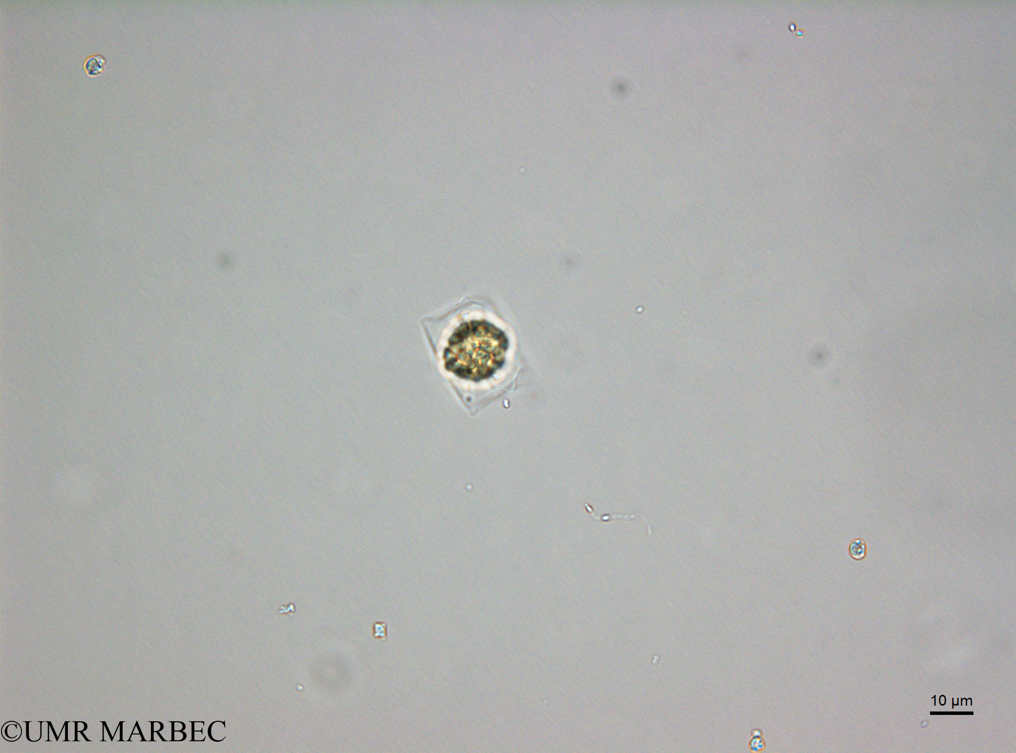 phyto/Scattered_Islands/juan_de_nova/COMMA2 November 2013/Cerataulina sp1 (D5_2_diatomee_ancien_melosira180717_001_ovl-4)(copy).jpg